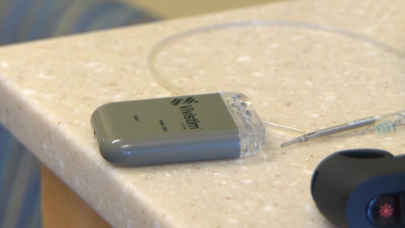 This device stimulates the Vagus nerve, which helps increase motor function in the hands and...